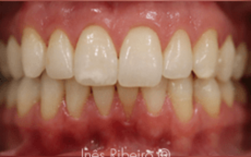 After - March Dental