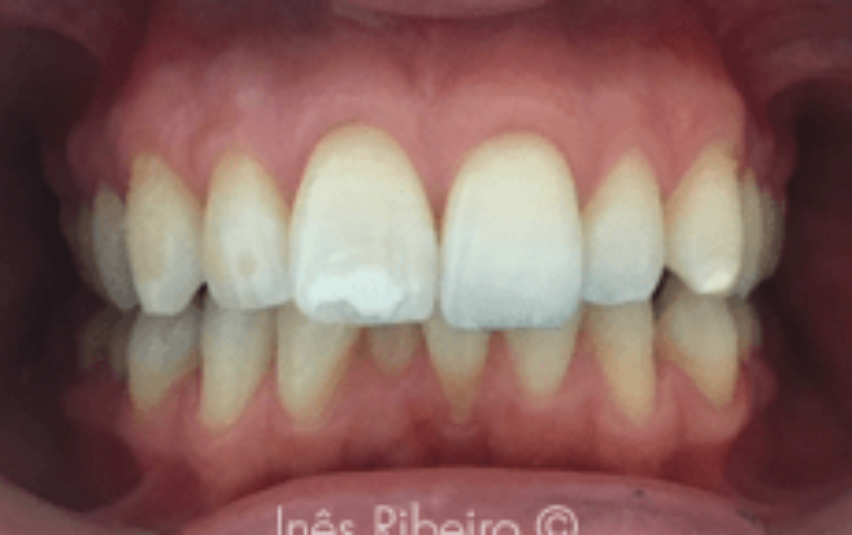 Before - March Dental